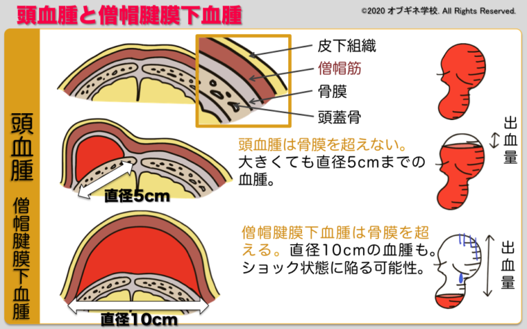【免疫グロブリン】これだけ覚える IgG,IgA ...