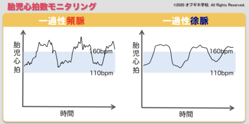 分娩介助トレーニングに使える胎児心音付きCTG波形 分娩介助トレーニングに使える胎児心音付きCTG波形 語学・辞書