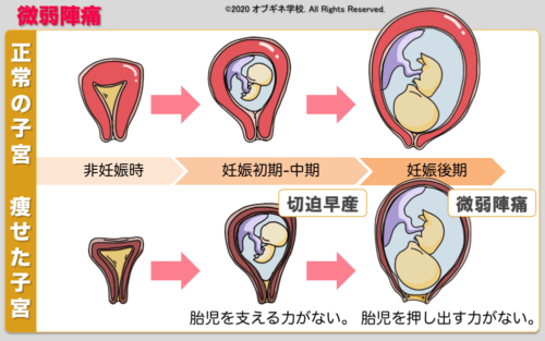 異常分娩編１ 概論 新しい切り口の産婦人科学 見えてくる産婦人科学 オブギネ学校