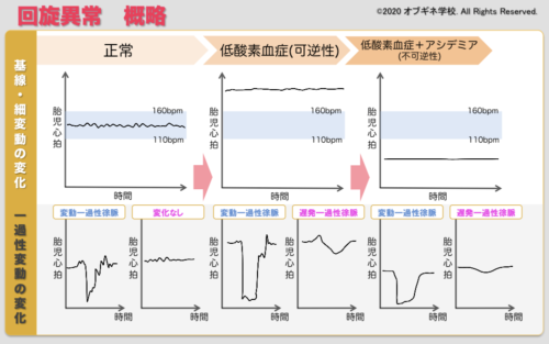 胎児心拍モニタリング編１ 新しい切り口の産婦人科学講座│見えてくる