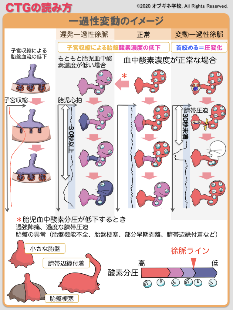 胎児心拍モニタリング編１ 新しい切り口の産婦人科学講座│見えてくる