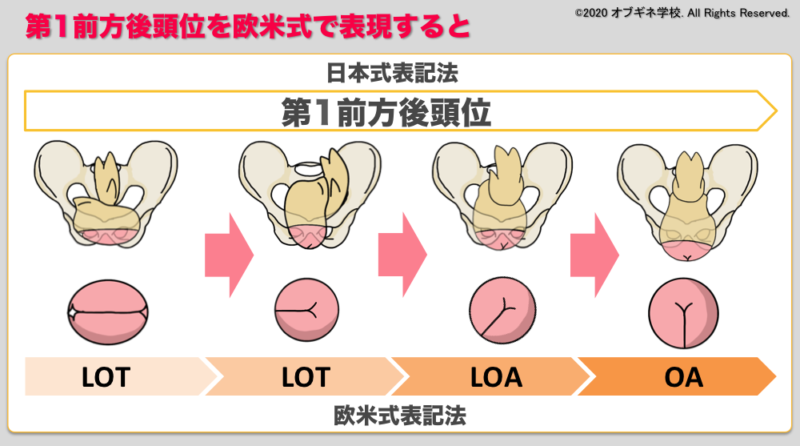 ALSO受験者必見！Lie, Presentation, Attitude, Position 欧米式の胎位・胎向・胎勢について│見えてくる産 ...