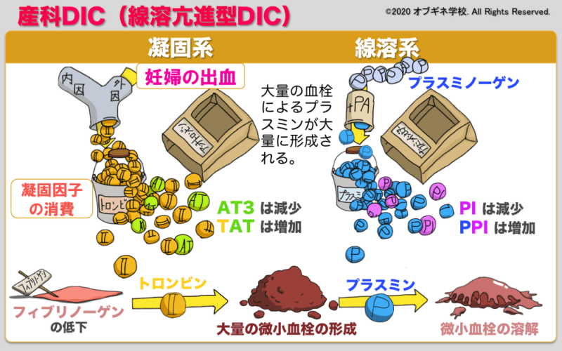 産科DICと血液凝固 新しい切り口の産婦人科学講座│見えてくる