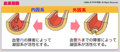 産科dicと血液凝固 新しい切り口の産婦人科学講座 見えてくる産婦人科学 オブギネ学校