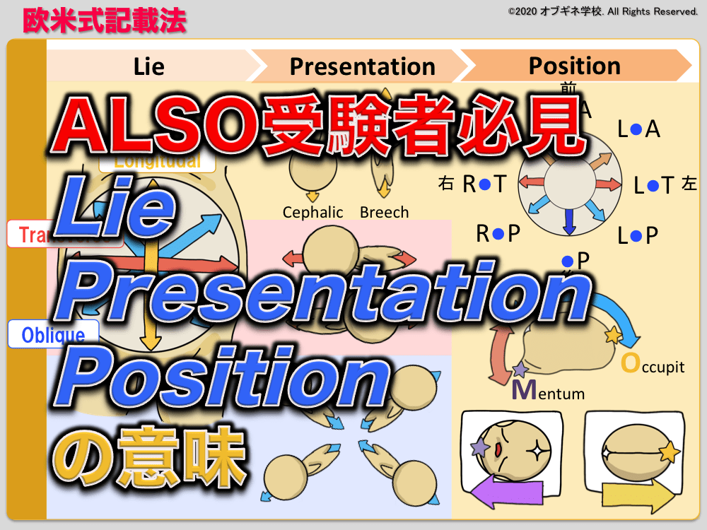 ALSO受験者必見！Lie, Presentation, Attitude, Position 欧米式の胎位・胎向・胎勢について│見えてくる産 ...
