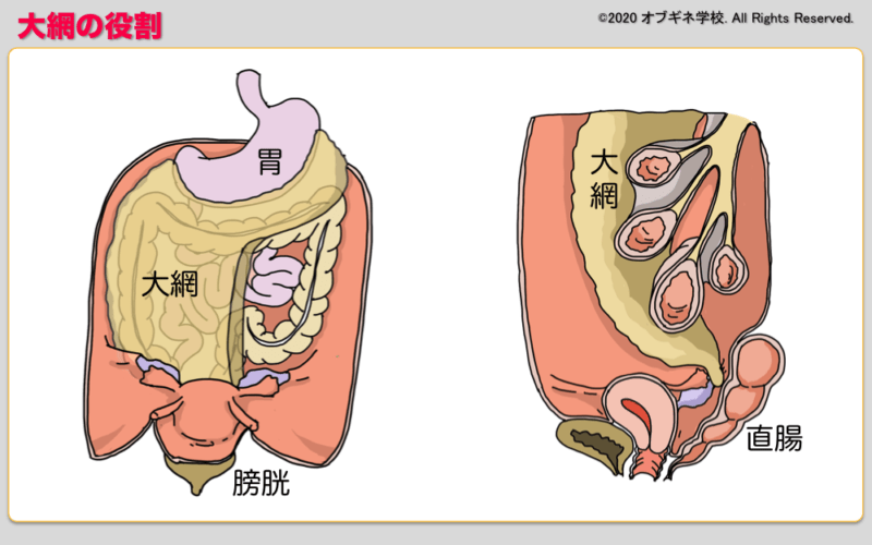 医学生のための婦人科癌手術の基本│見えてくる産婦人科学 オブギネ学校