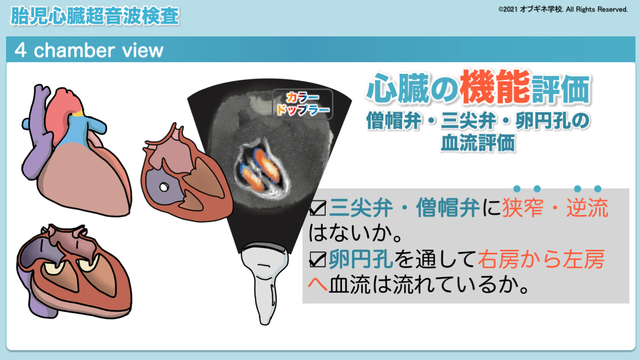 こんな解説が欲しかった！胎児心臓超音波検査│見えてくる産婦人
