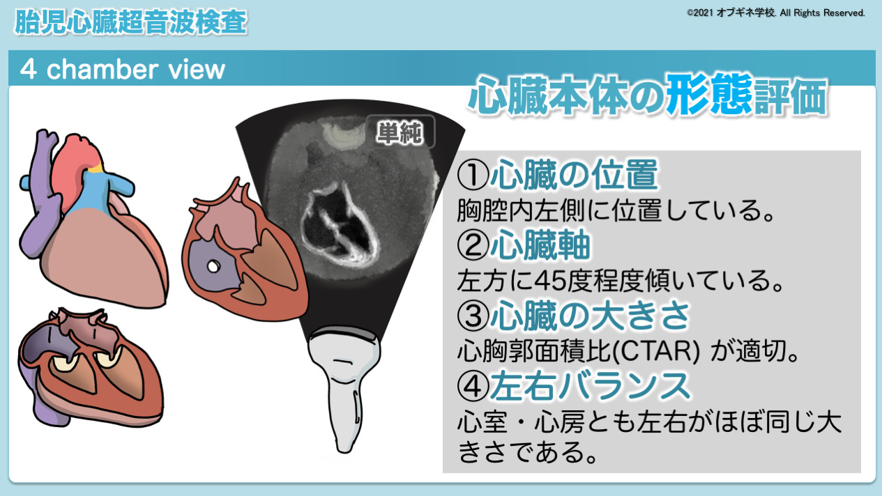 こんな解説が欲しかった！胎児心臓超音波検査│見えてくる産婦人科学