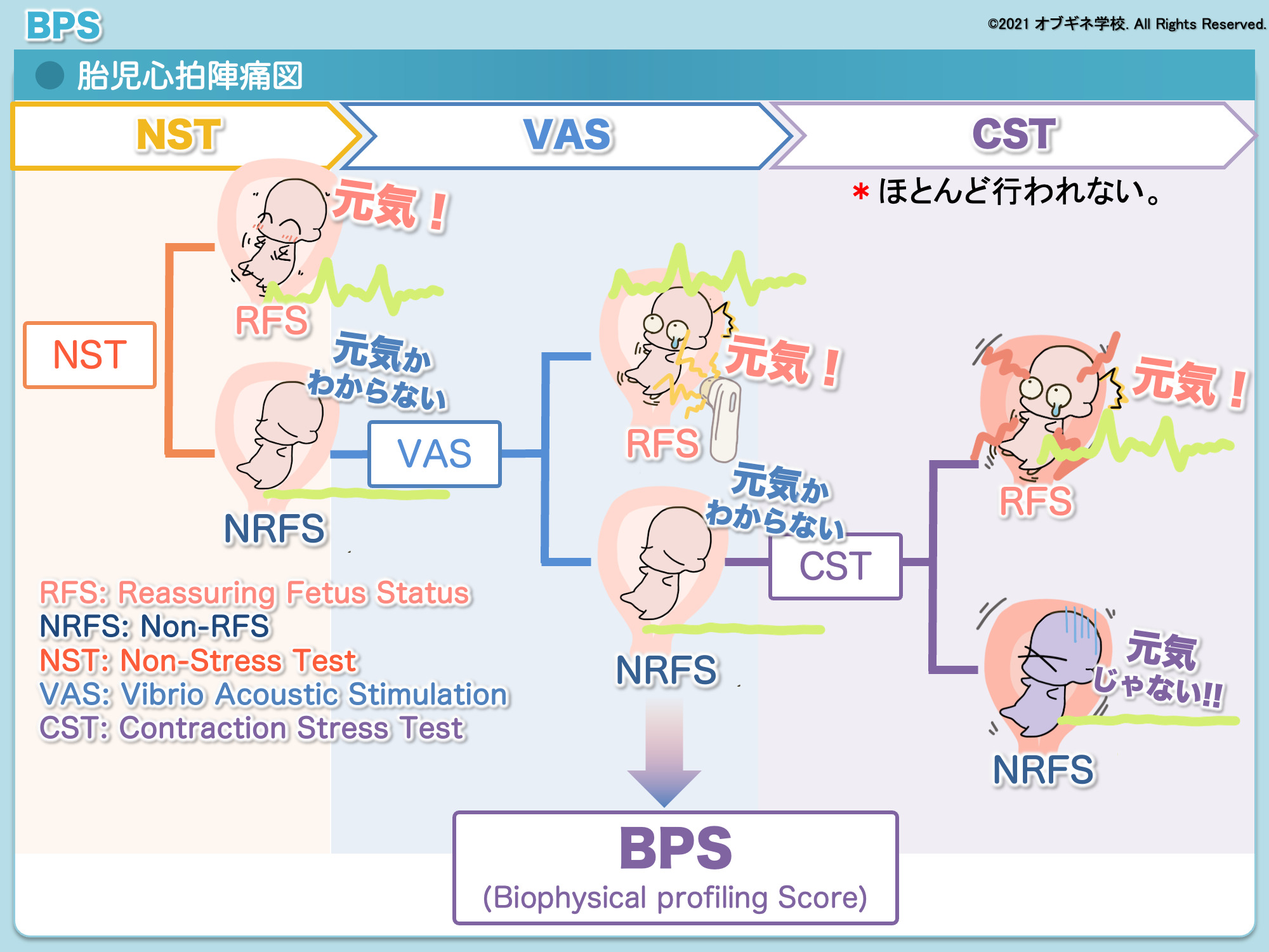 もう暗記しない！面白いほど理解できるbps 徹底解説 Part2│見えてくる産婦人科学 オブギネ学校